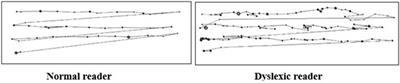 A Temporal Sampling Basis for Visual Processing in Developmental Dyslexia